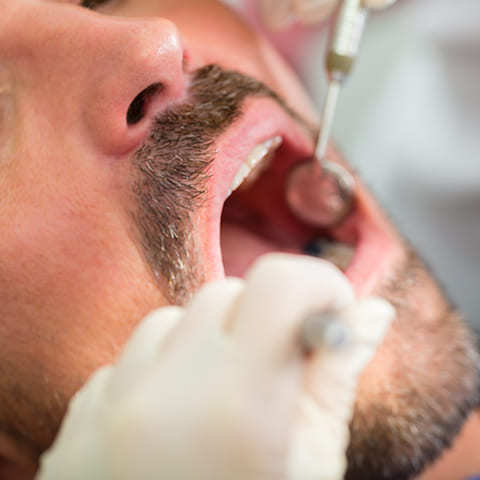 Les soins dentaires - Régime Professionnel de Santé - IRP AUTO